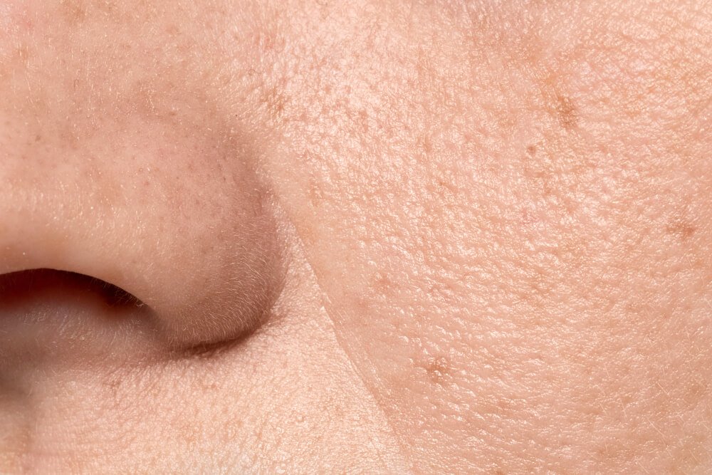 The Best Oils for Oily Skin That Don’t Clog Pores